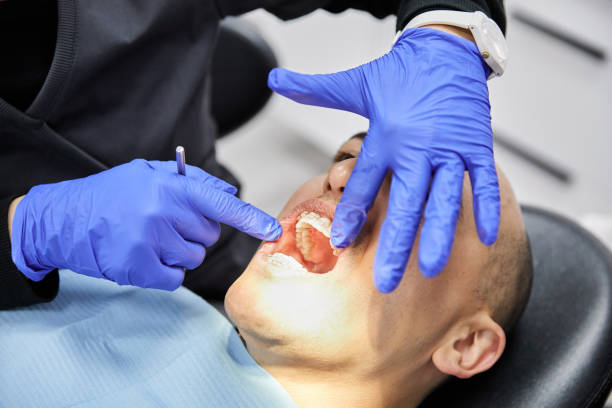 Best Emergency Wisdom Tooth Extraction in Whippany, NJ