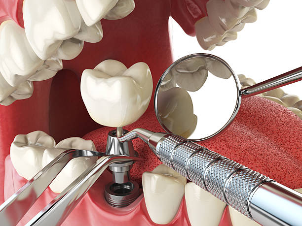 Best Emergency Treatment for Oral Infections in Whippany, NJ